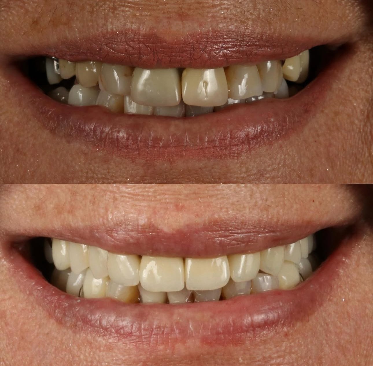Prótesis dental - clínica